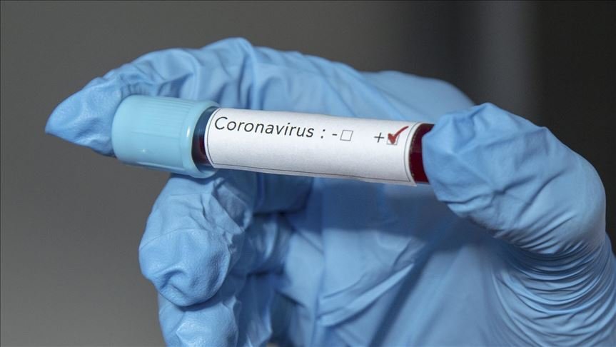 Coronavirus Prueba