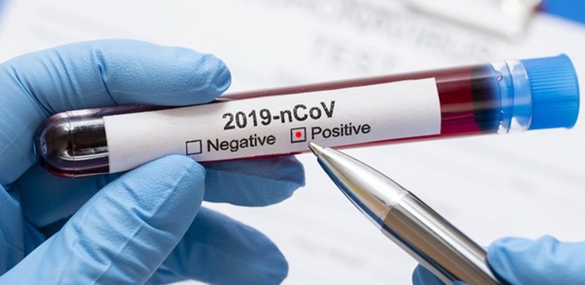 Coronavirus 3 de julio 2020